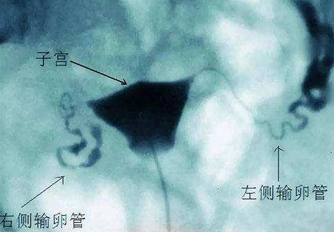 苏州助孕机构,助孕生孩子骗局有哪些？