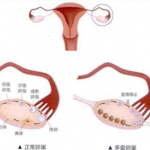 [热搜]苏州三代试管生孩子价格是多少